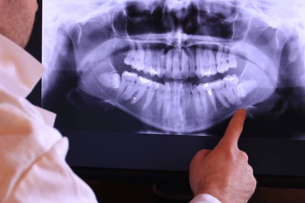 Best Emergency Treatment for Dental Infections or Abscesses in Seymour, TN